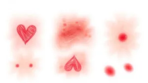 疤痕的類型及特點